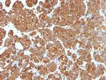 ACTH (Adrenocorticotrophic Hormone) (Pituitary Marker) Antibody in Immunohistochemistry (Paraffin) (IHC (P))