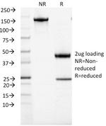 ACTH (Adrenocorticotrophic Hormone) (Pituitary Marker) Antibody in SDS-PAGE (SDS-PAGE)