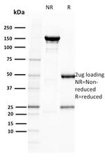 BOB.1 Antibody in SDS-PAGE (SDS-PAGE)