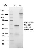 ATRX/RAD54 (Alpha Thalassemia Mental Retardation) Antibody in SDS-PAGE (SDS-PAGE)