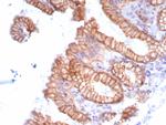 Migfilin-1/FBLIM1 Antibody in Immunohistochemistry (Paraffin) (IHC (P))