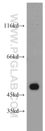 HTRA1 Antibody in Western Blot (WB)
