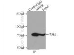 p75NTR Antibody in Immunoprecipitation (IP)