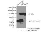 NBS1 Antibody in Immunoprecipitation (IP)