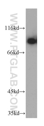 NBS1 Antibody in Western Blot (WB)