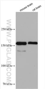 MAGI1 Antibody in Western Blot (WB)