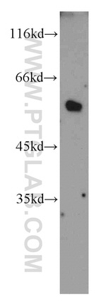 PKMYT1 Antibody in Western Blot (WB)