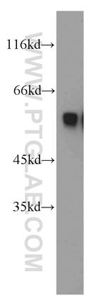 PKMYT1 Antibody in Western Blot (WB)