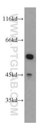 PKMYT1 Antibody in Western Blot (WB)