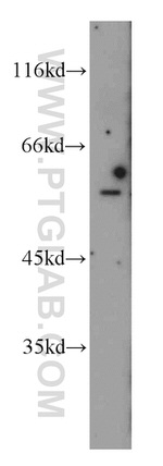 PKMYT1 Antibody in Western Blot (WB)