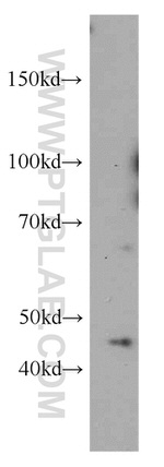 MAGEA1 Antibody in Western Blot (WB)