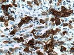 CD30 Antibody in Immunohistochemistry (Paraffin) (IHC (P))