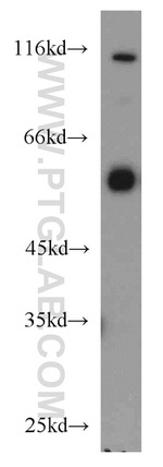 PTBP2 Antibody in Western Blot (WB)