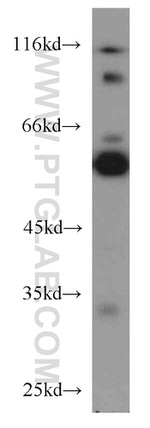 PTBP2 Antibody in Western Blot (WB)