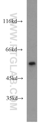 PTBP2 Antibody in Western Blot (WB)