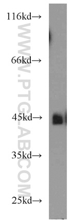 MBD2 Antibody in Western Blot (WB)