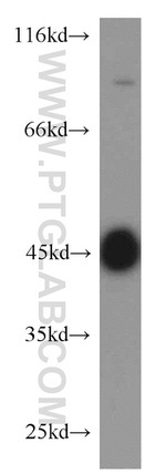 MBD2 Antibody in Western Blot (WB)