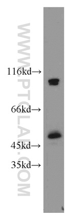 MBD2 Antibody in Western Blot (WB)