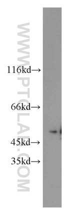 MBD2 Antibody in Western Blot (WB)