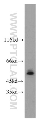 MBD2 Antibody in Western Blot (WB)