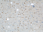 ENO1 Antibody in Immunohistochemistry (Paraffin) (IHC (P))