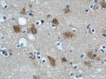 ENO1 Antibody in Immunohistochemistry (Paraffin) (IHC (P))