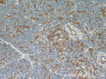 ENO1 Antibody in Immunohistochemistry (Paraffin) (IHC (P))