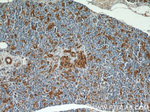 ENO1 Antibody in Immunohistochemistry (Paraffin) (IHC (P))