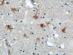 ENO1 Antibody in Immunohistochemistry (Paraffin) (IHC (P))