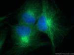 PARVA Antibody in Immunocytochemistry (ICC/IF)