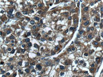 PARVA Antibody in Immunohistochemistry (Paraffin) (IHC (P))