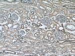 PARVA Antibody in Immunohistochemistry (Paraffin) (IHC (P))