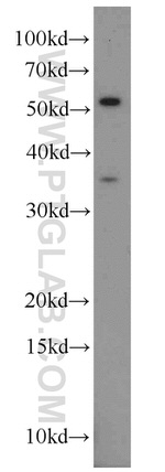 PARVA Antibody in Western Blot (WB)