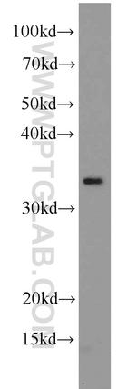 PARVA Antibody in Western Blot (WB)