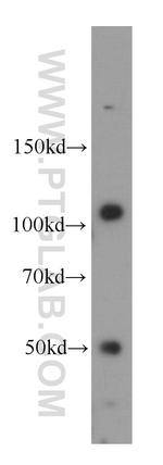 CASK Antibody in Western Blot (WB)