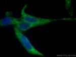 RAB8A Antibody in Immunocytochemistry (ICC/IF)