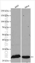 RAB8A Antibody in Western Blot (WB)