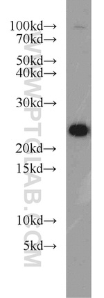 RAB8A Antibody in Western Blot (WB)