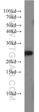 RAB8A Antibody in Western Blot (WB)