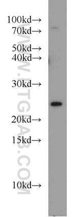 RAB8A Antibody in Western Blot (WB)