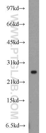 RAB8A Antibody in Western Blot (WB)