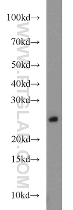 RAB8A Antibody in Western Blot (WB)