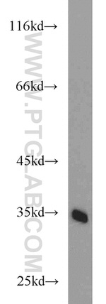 PKA C-beta Antibody in Western Blot (WB)