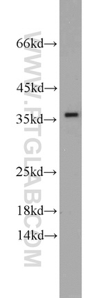 PKA C-beta Antibody in Western Blot (WB)