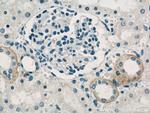 PKA C-beta Antibody in Immunohistochemistry (Paraffin) (IHC (P))