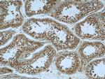 KIF15 Antibody in Immunohistochemistry (Paraffin) (IHC (P))