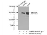 KIF15 Antibody in Immunoprecipitation (IP)