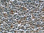 CCR7 Antibody in Immunohistochemistry (Paraffin) (IHC (P))