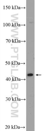 GATA5 Antibody in Western Blot (WB)