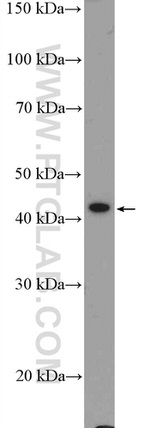 GATA5 Antibody in Western Blot (WB)